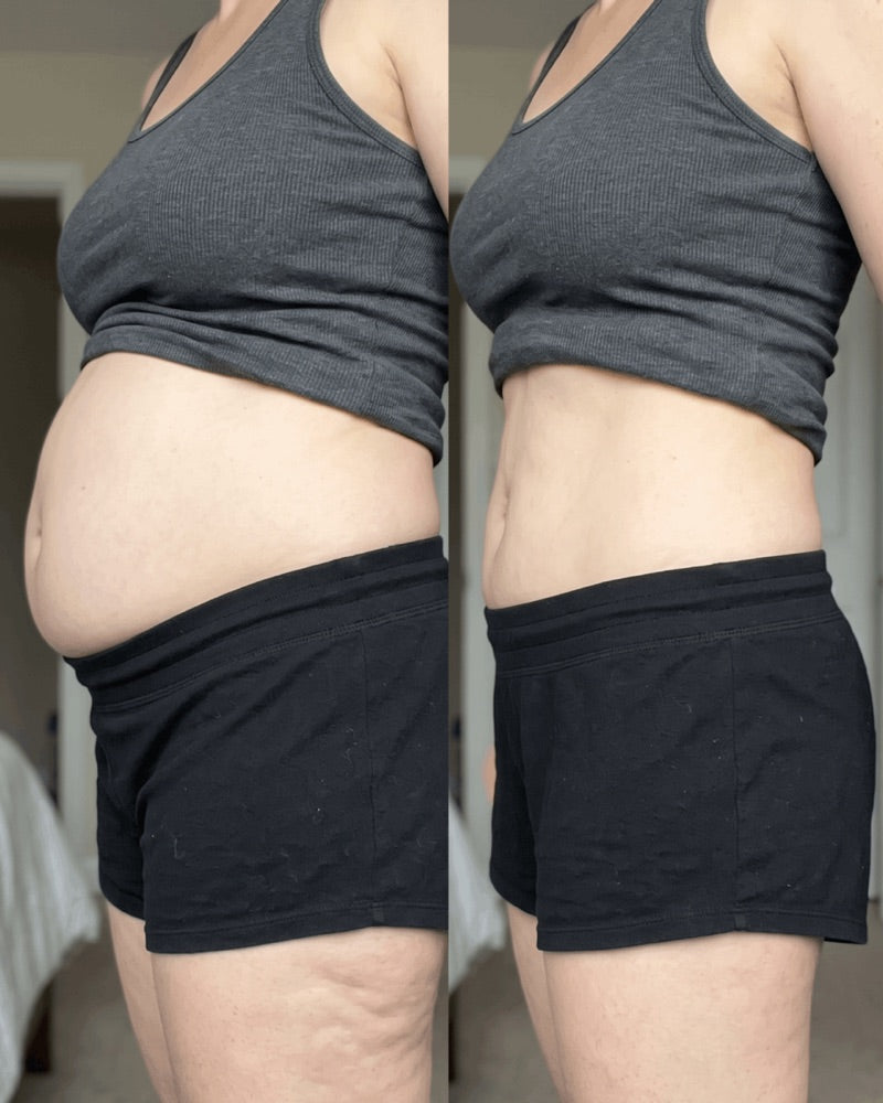 Customer photo: midsection in profile, before and after