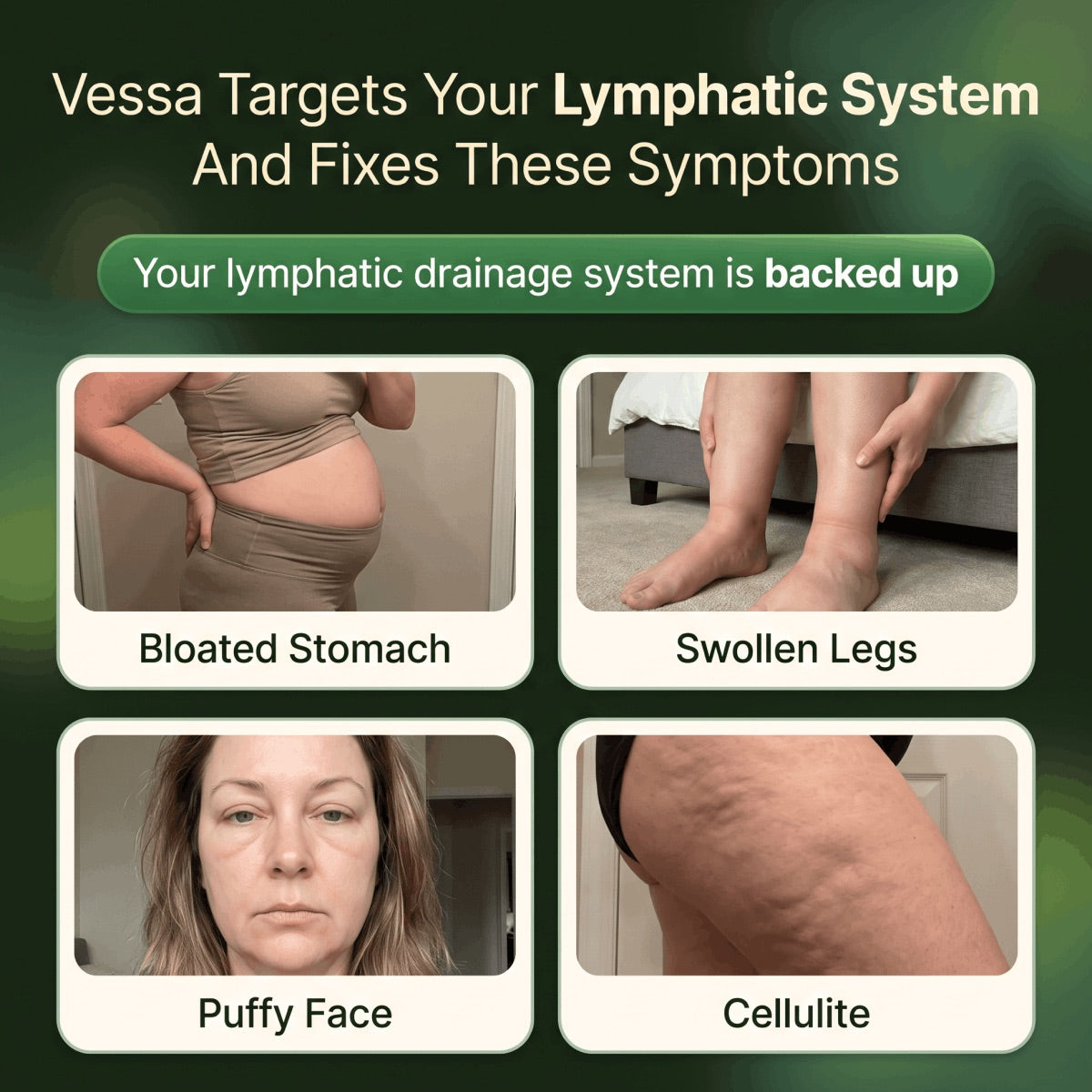 The four symptoms Lymph+ targets: bloated stomach, swollen legs, puffy face, cellulite